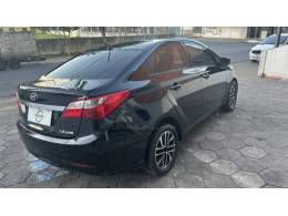 HYUNDAI - HB20S - 2014/2014 - Preta - R$ 22.990,00